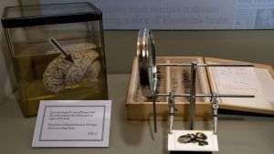 Imagen del cerebro de Einstein